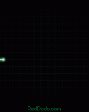 http://nimbuzzgroup.xtgem.com/sam/ecg176x220.gif